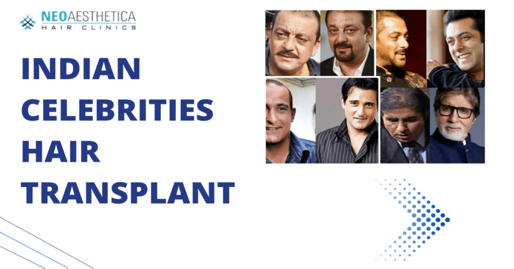 Indian celebrities hair transplant