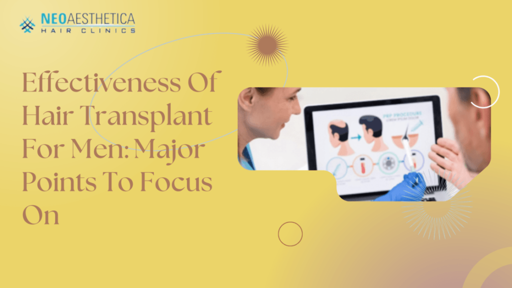 Hair Transplant For Men