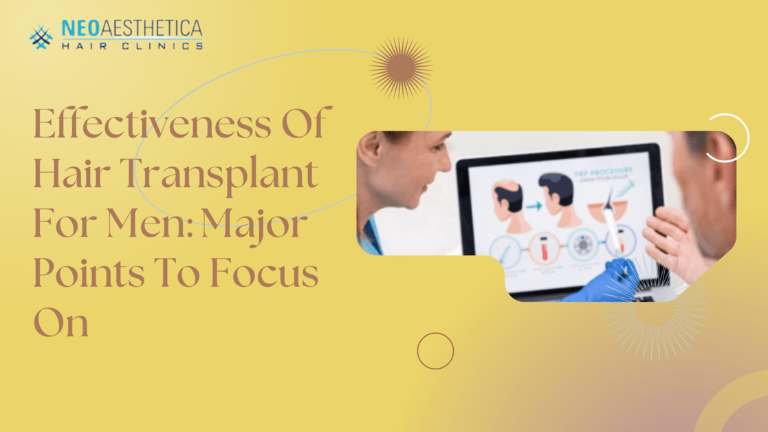 Hair Transplant For Men