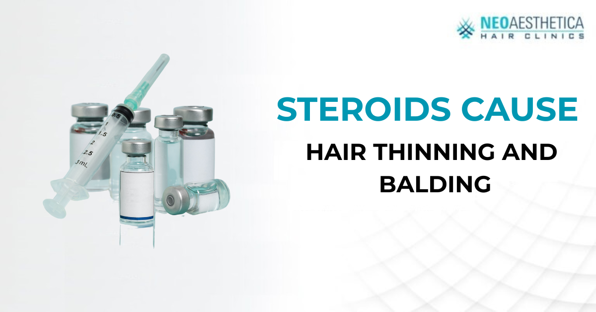 do-steroids-cause-hair-thinning-and-balding