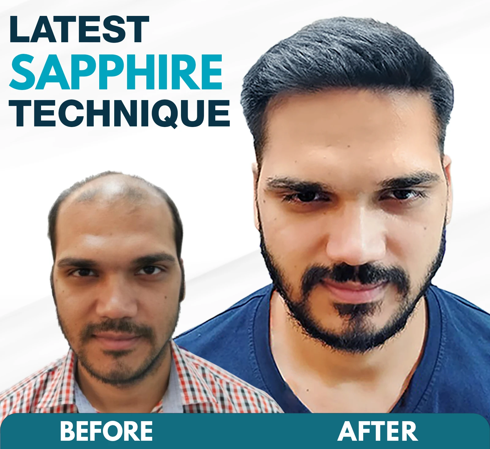bald-change